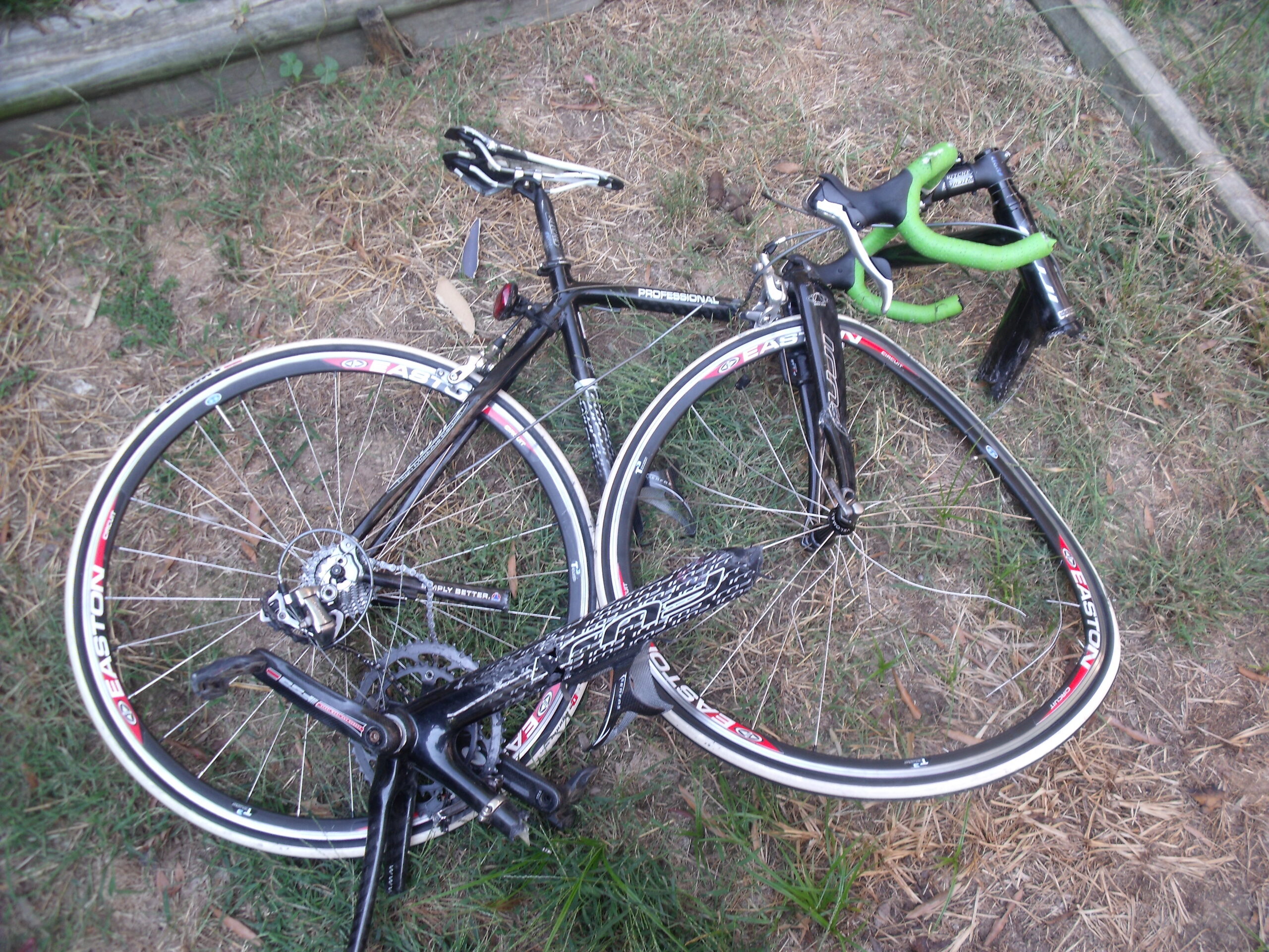 "Make sure you know the "IOUs" you may have to pay out of your bike crash injury case," recommends herndon Reston bicycle accident lawyer Doug Landau